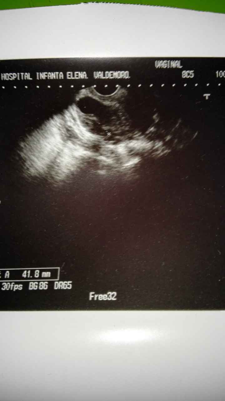 niña???