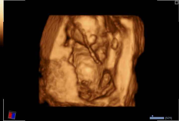 mi niño o mi niñaaa =)