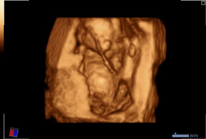 mi niño o mi niñaaa =)