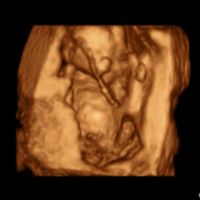 mi niño o mi niñaaa =)