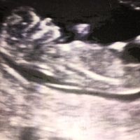 Niña o niño?