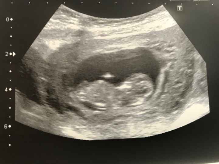 Futuras mamás Octubre 2018!!! - 1