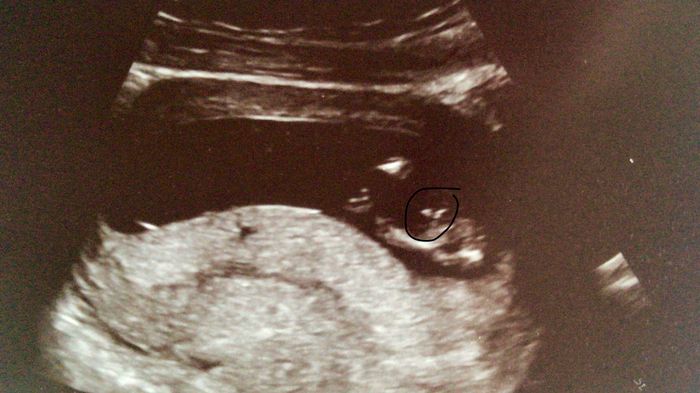 Futuras mamás Octubre 2018!!! - 1