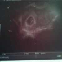 Ayuda con método ramzi: niño o niña? - 1