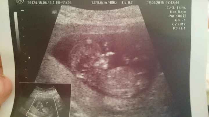 Mamis enero 2016 - 2