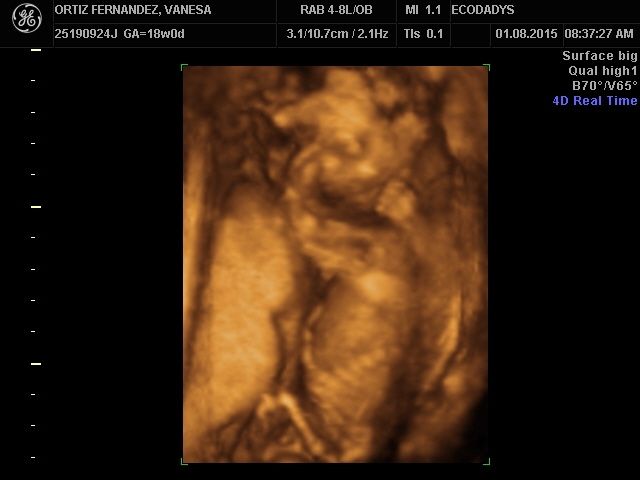 Mamis enero 2016 - 3