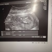 niño o niña??