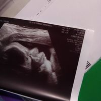 Futuras mamás Septiembre 2020 - 1