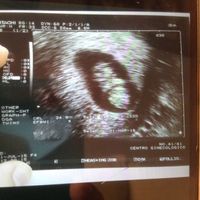 Mamis marzo 2016 - 1