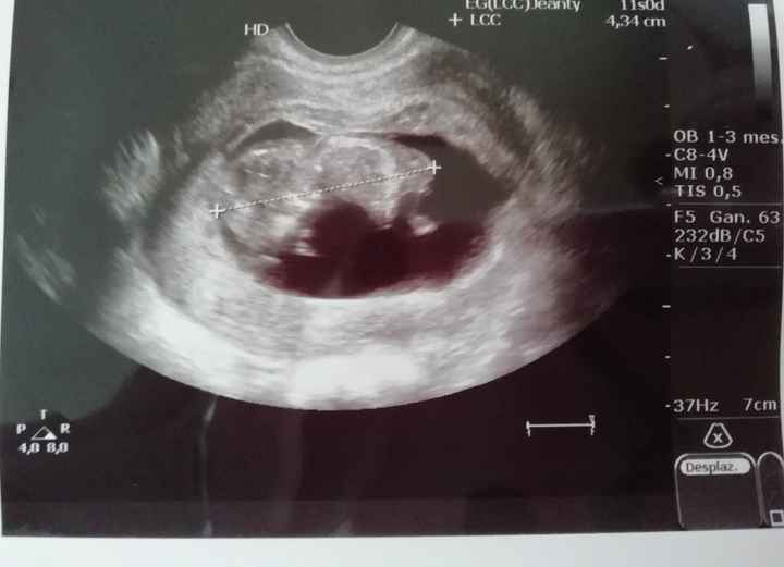 11 semanas 2