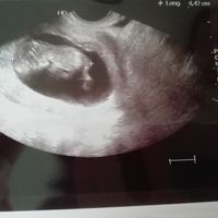 11 semanas