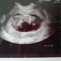 11 semanas 2