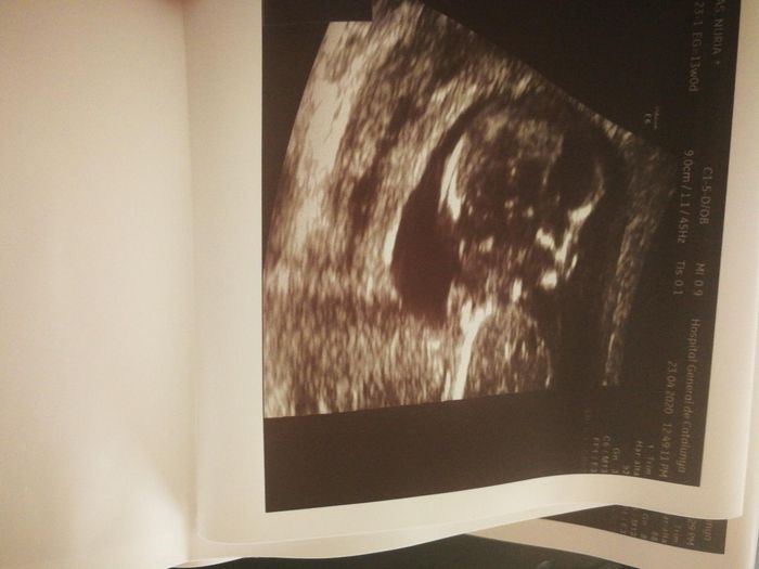 Futuras mamas octubre 2020 - 1