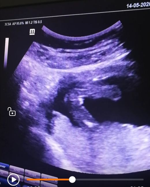 Futuras mamas octubre 2020 - 1