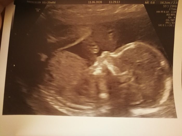 Futuras mamas octubre 2020 - 1