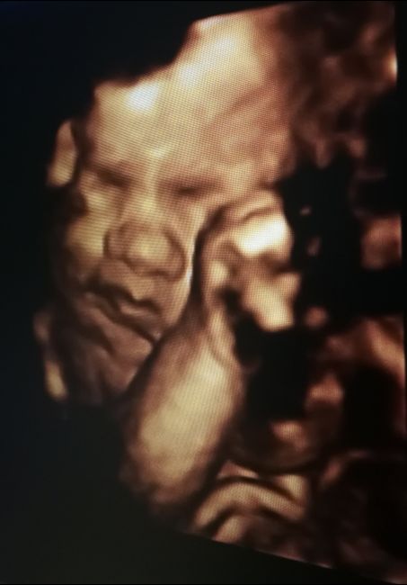 Futuras mamas octubre 2020 - 1