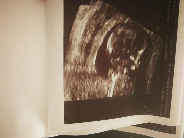 Futuras mamas octubre 2020 - 1