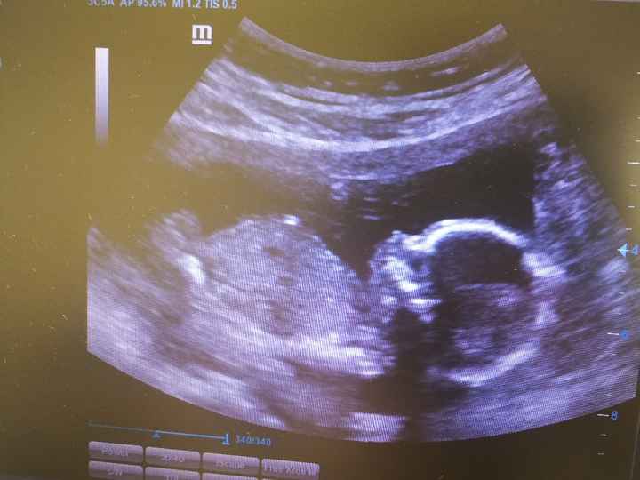 Futuras mamas octubre 2020 - 1