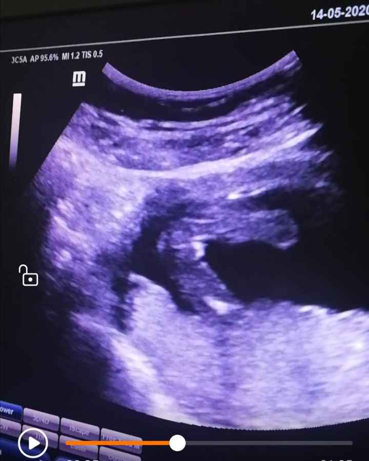 Futuras mamas octubre 2020 - 1