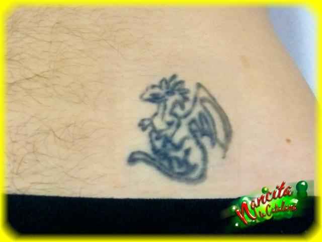 Eliminaciòn tatuaje en pelvis.