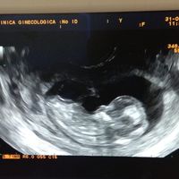 Futuras mamás marzo 2019 - 1