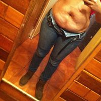 Segunda sesión de mesoterapia - 1