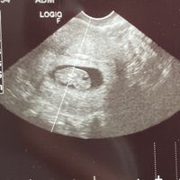 Ayuda con método ramzi: niño o niña? - 1