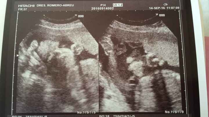 Futuras mamás diciembre 2016. - 1