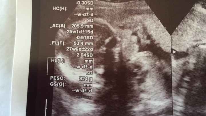 Futuras mamás diciembre 2016. - 2