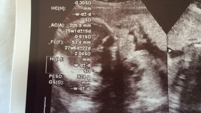 Futuras mamás diciembre 2016. - 2