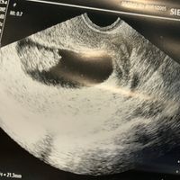 Futuras mamis junio 2021 🤰🏻❤️ oficial - 1