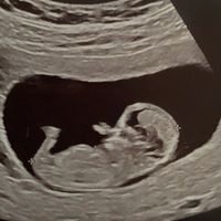 Futuras mamis junio 2021 🤰🏻❤️ oficial - 1