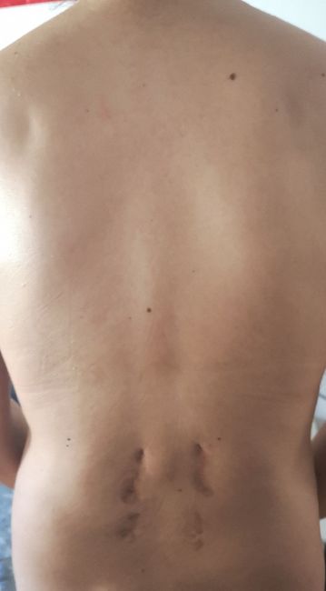 Parto sin epidural 2
