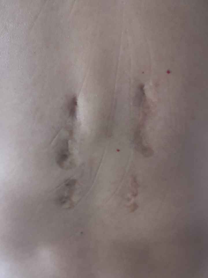 Parto sin epidural - 1