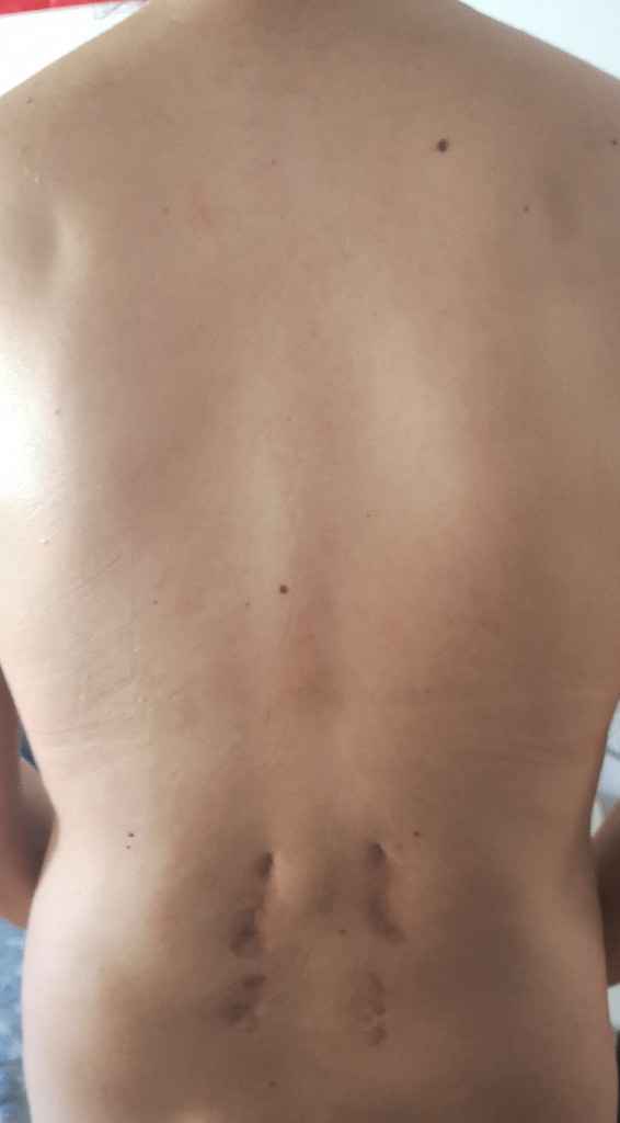Parto sin epidural - 2