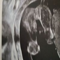 Futuras mamás Junio 2020 - 1