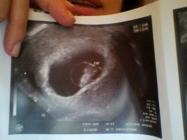 7 semanas y 5 dias