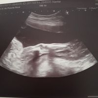 y por ultimo os presento su laaarga pierna jejejej