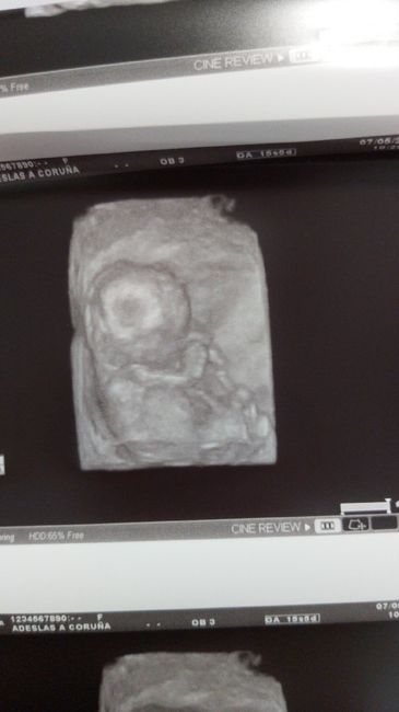 Futuras mamas octubre 2020 - 1