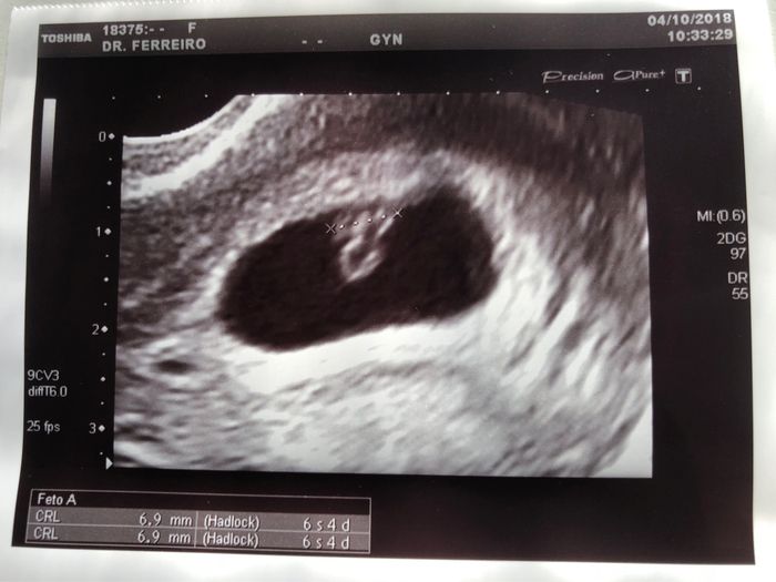 Futuras mamas julio 2019 - 1