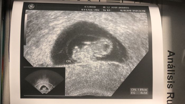 Futuras mamás septiembre 2019 3