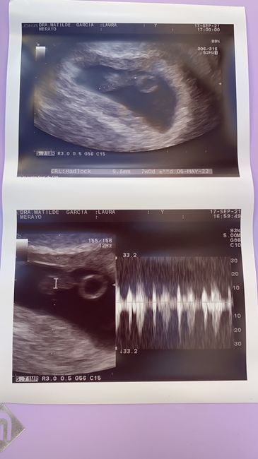 futuras mamis mayo 2022 🤰 1