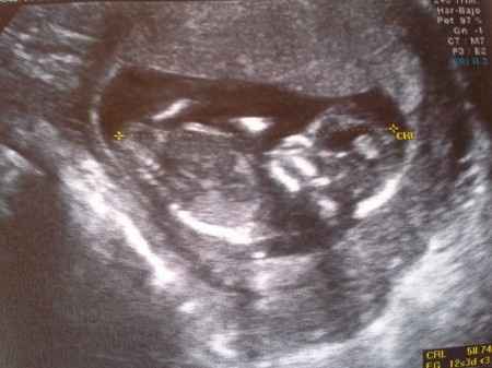 El consultorio de Lita para futuras mamis - 2