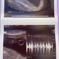 futuras mamis mayo 2022 🤰 - 1
