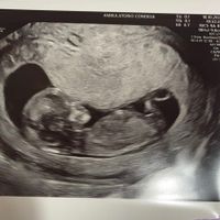 futuras mamis mayo 2022 🤰 - 1