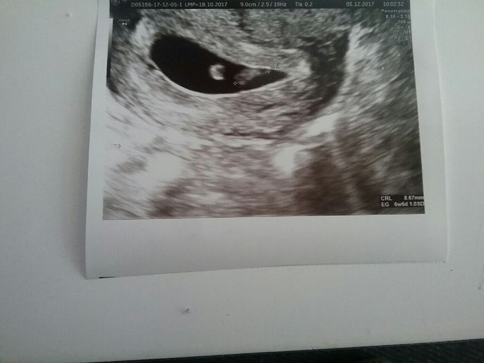 Futuras Mamis Julio 2018 1
