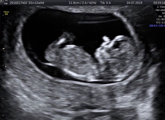 Mamas Febrero 2020 - 1