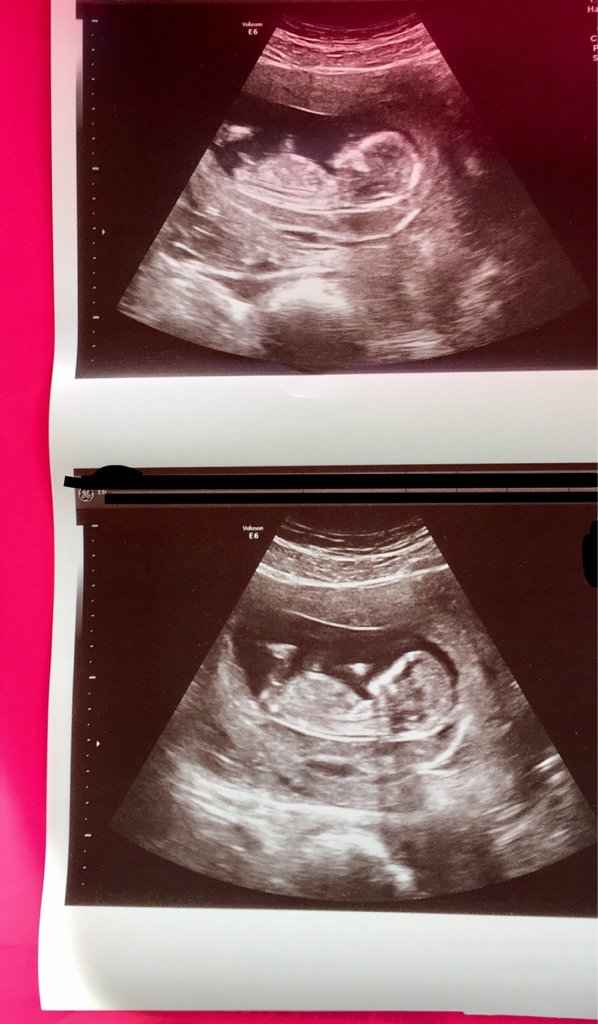 Futuras mamis diciembre 2017 - 1