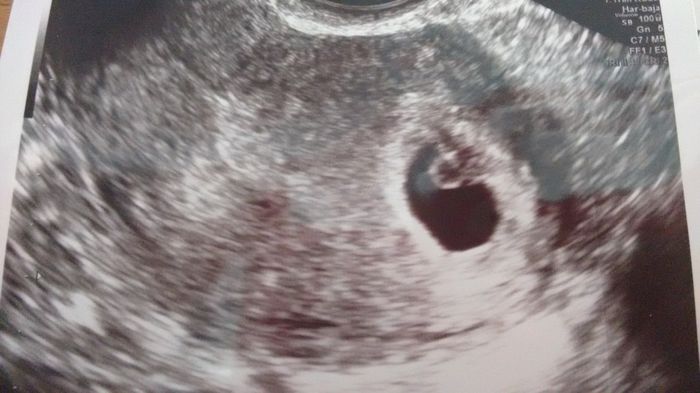 Mi bebe
