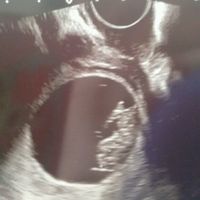 Mamis marzo 2016 - 1
